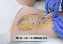 Средство для роста ресниц Карепрост