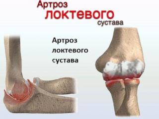 Средство для роста ресниц Карепрост